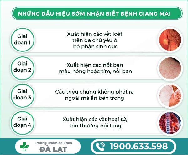 Hình ảnh minh họa